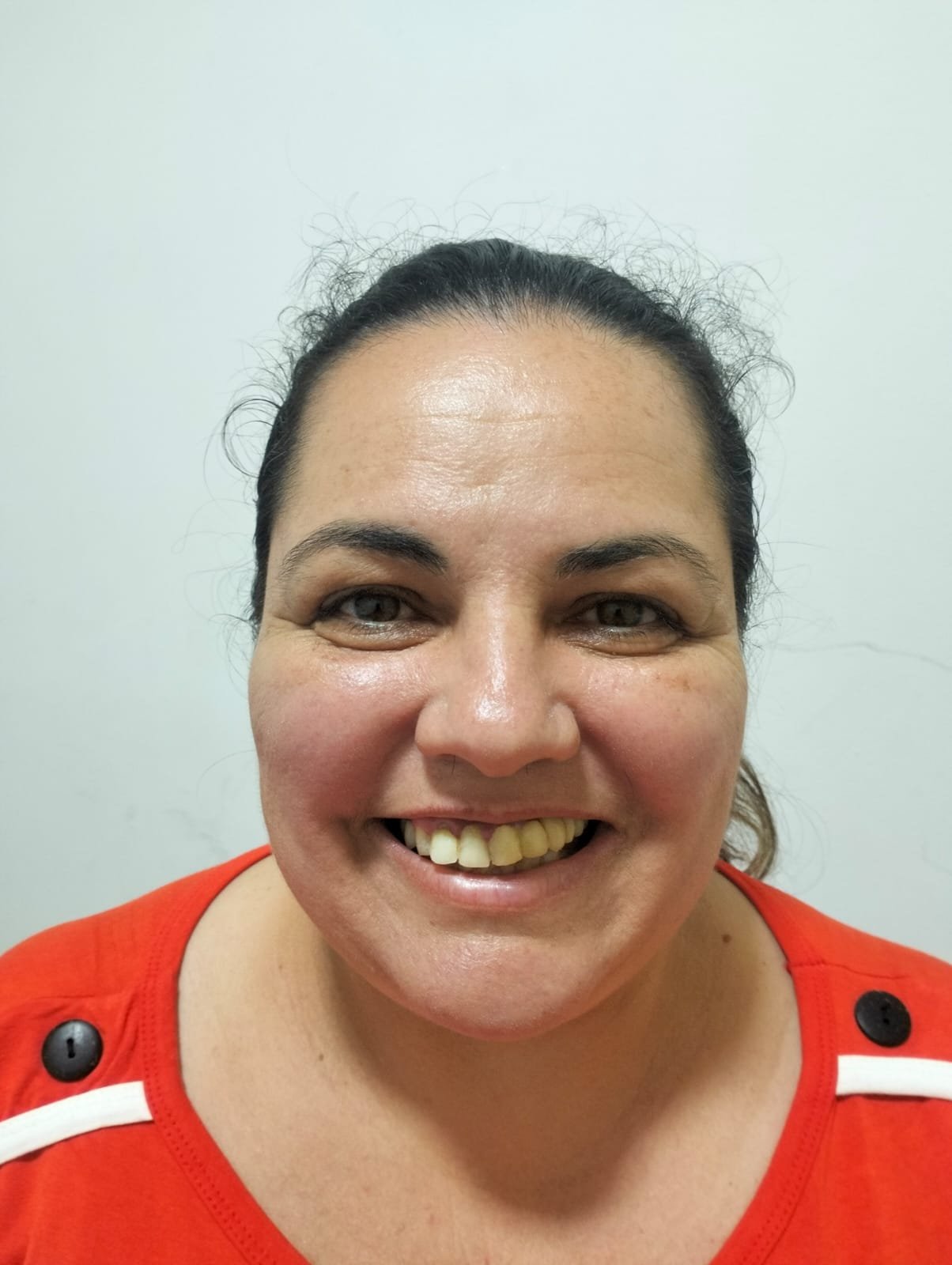Antes da reabilitação oral