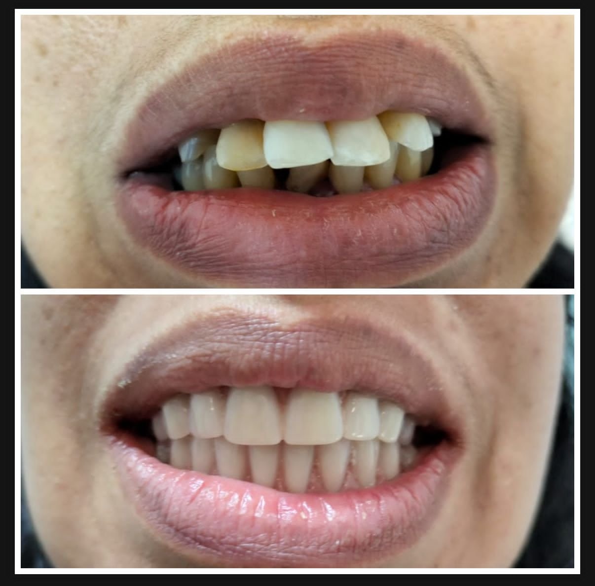 Resultado odontológico antes e depois